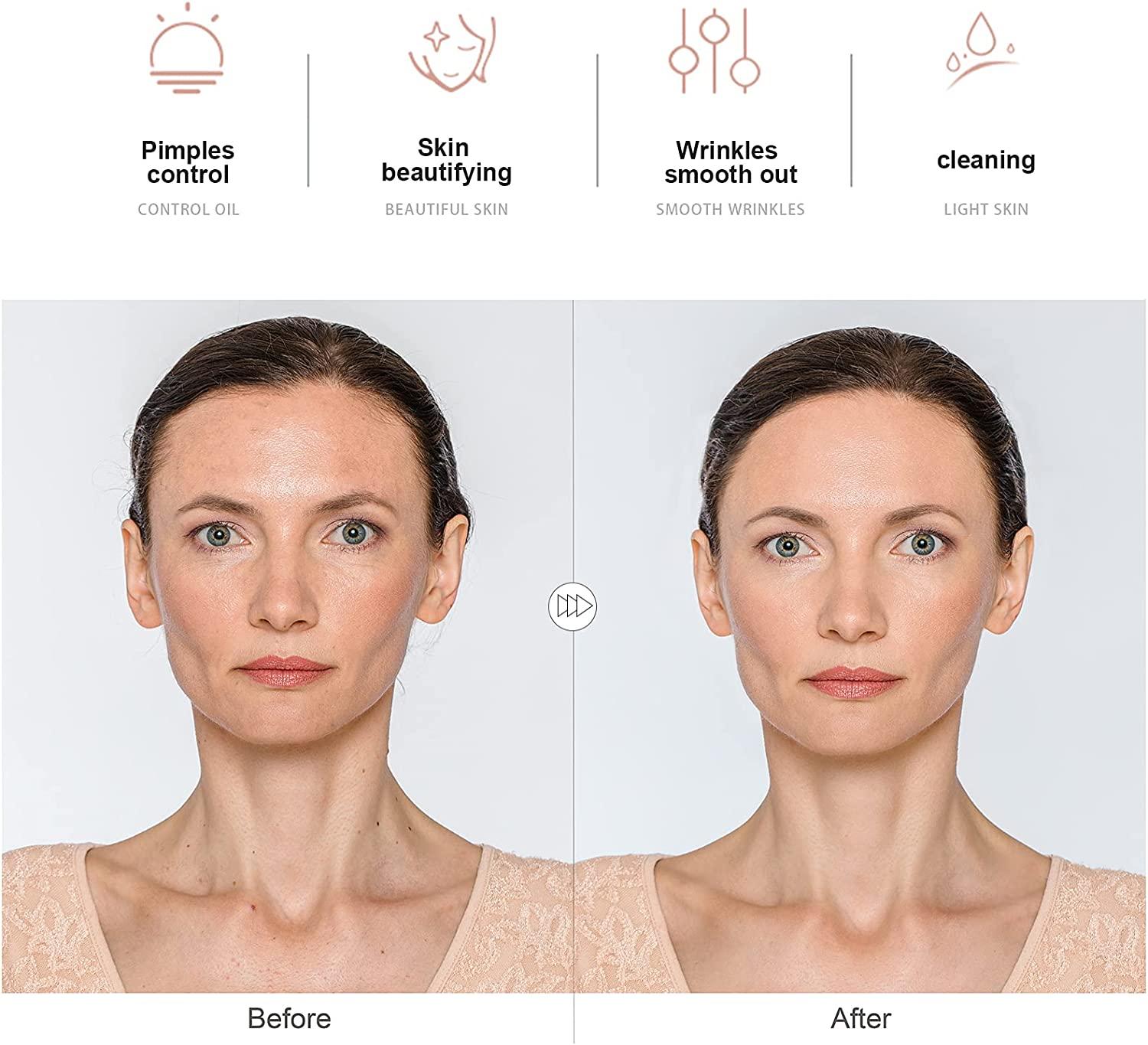 NewWay High Frequency Facial Wand Light Therapy Machine