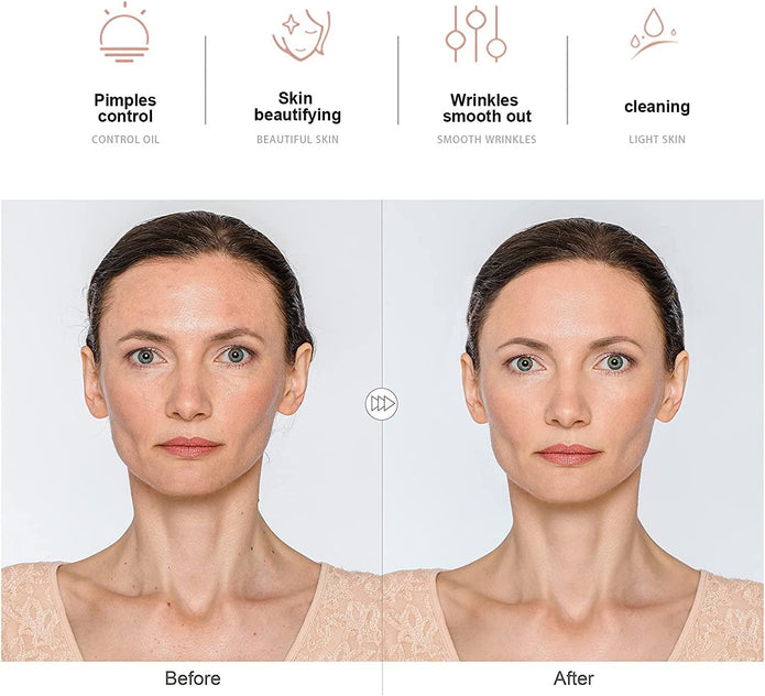 NewWay High Frequency Facial Wand Light Therapy Machine