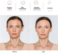 NewWay High Frequency Facial Wand Light Therapy Machine