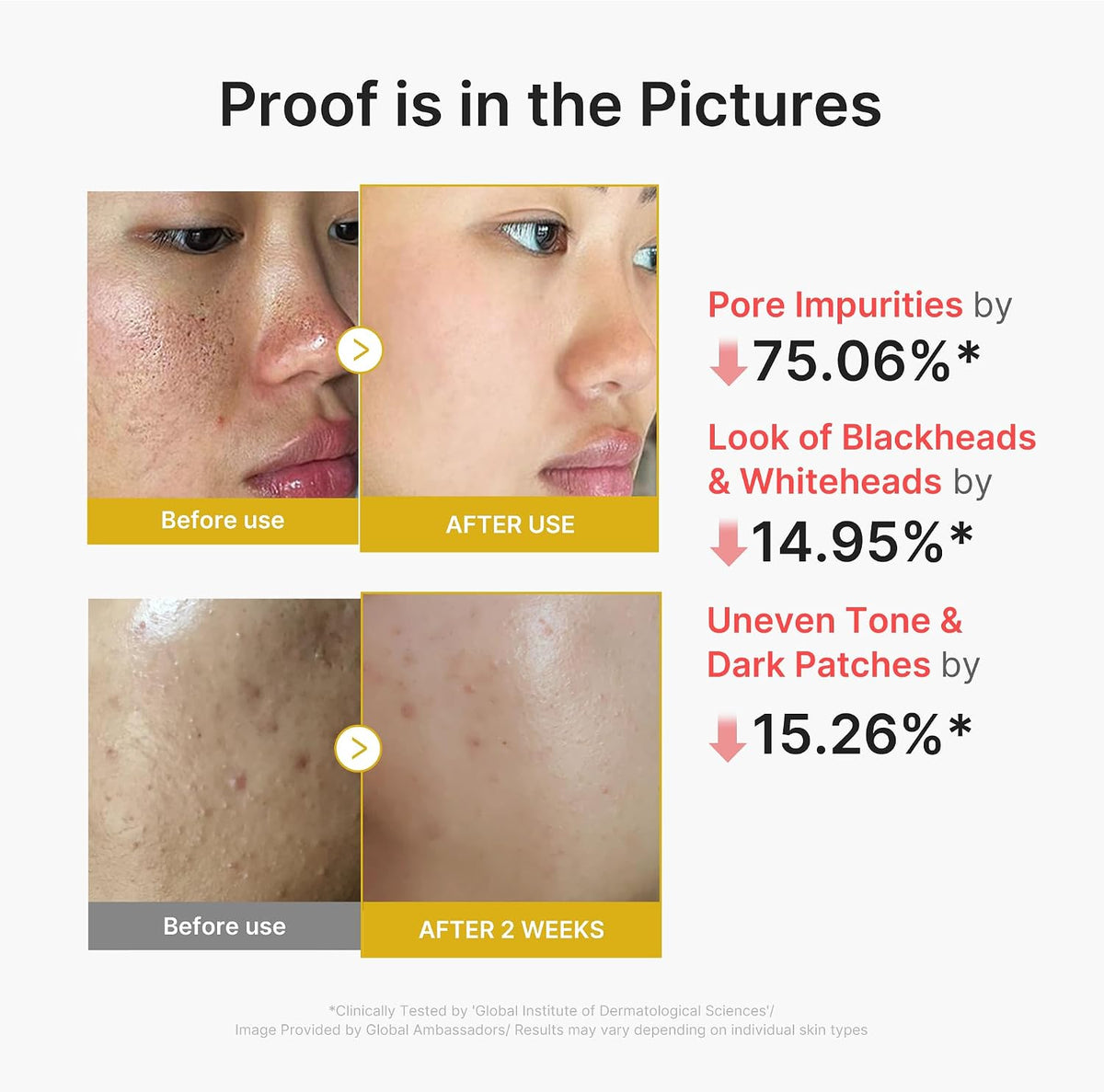 medicube Peel Shot with Kojic Acid Turmeric | Reset in One Step | Gentle Exfoliating Serum with BHA, LHA, PHA for Dead Skin Cells, Blackheads, Excess Sebum | For Dull, Rough, Troubled Skin | 2.7 fl.oz 80ml