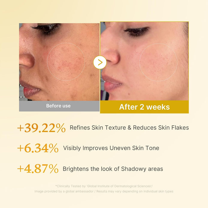 medicube Kojic Acid Turmeric Smoothing Toner for Face & Body | Lightweight Toner for Balancing Uneven Skin Tone & Texture | Niacinamide, Glycolic Acid for Clear Glass Skin | 8.45 fl.oz